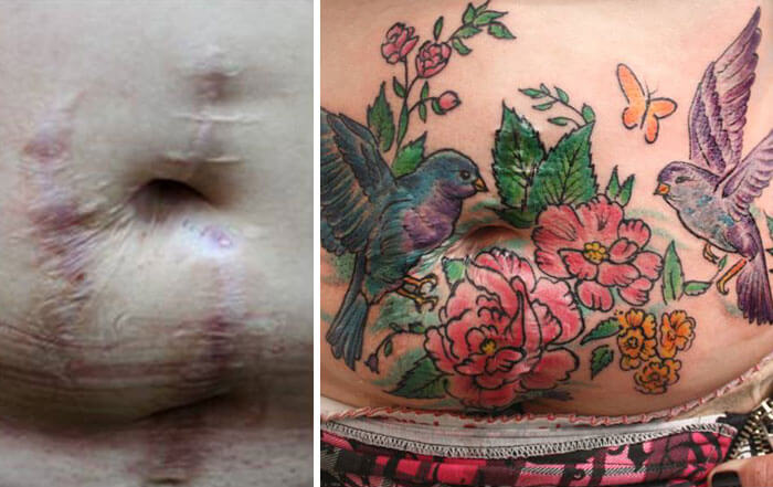 portalraizes.com - Brasileira faz tatuagens gratuitas para mulheres que sofreram violência doméstica