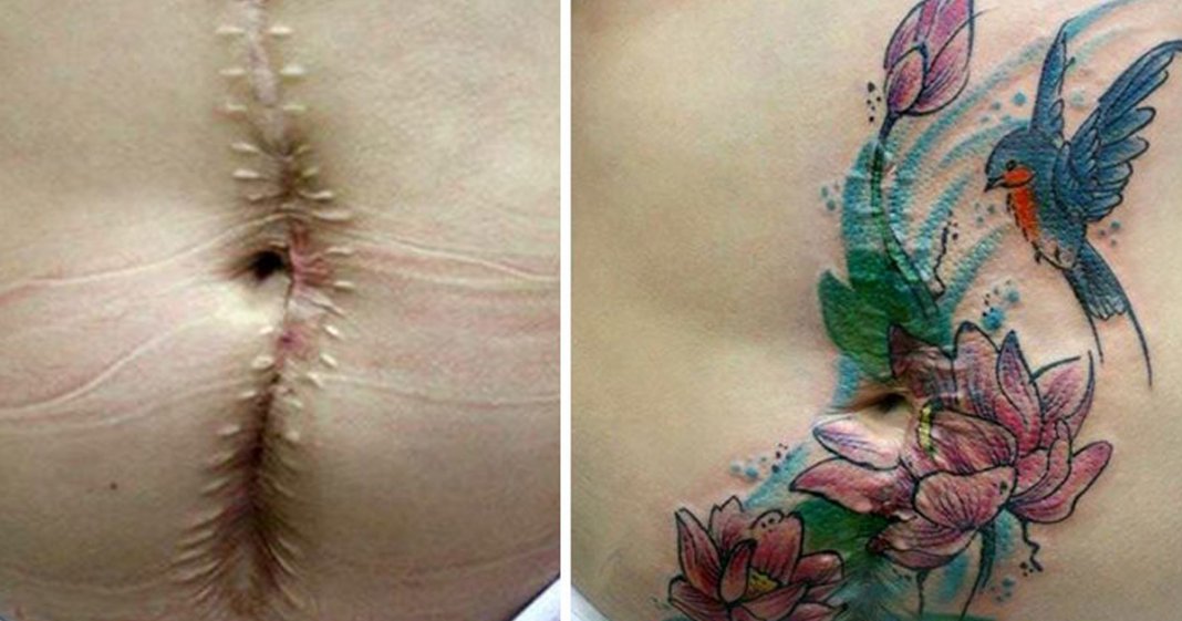 Brasileira faz tatuagens gratuitas para mulheres que sofreram violência doméstica