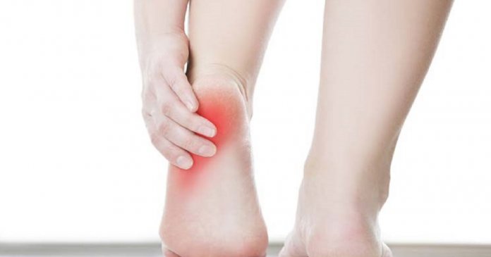 fascite-plantar