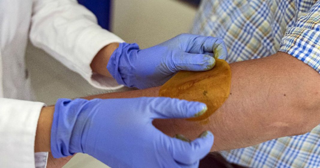 Pesquisadores criam adesivo que regenera pele de pessoas diabéticas em 21 dias