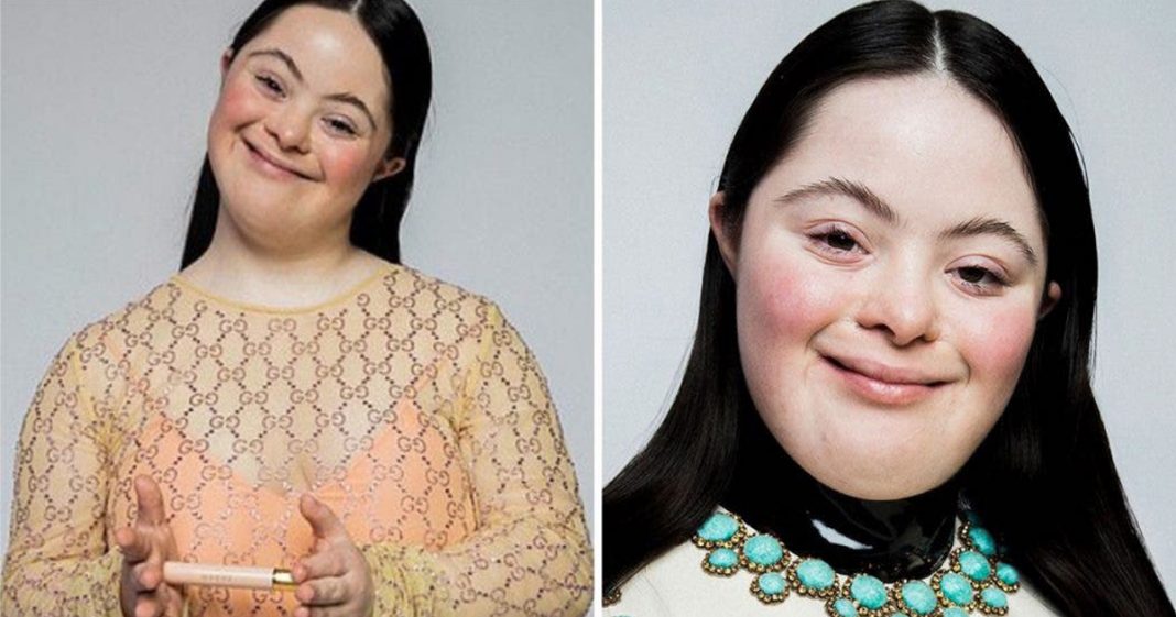 Jovem com síndrome de Down é o novo rosto de campanha da Gucci: diversidade