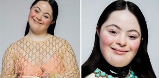 Jovem com síndrome de Down é o novo rosto de campanha da Gucci: diversidade