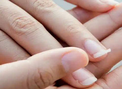 portalraizes.com - A apar&ecirc;ncia das unhas conta como est&aacute; a sa&uacute;de f&iacute;sica e mental, alerta especialistas