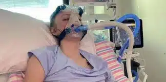 Adolescente desenvolve doença rara após o uso de cigarro eletrônico