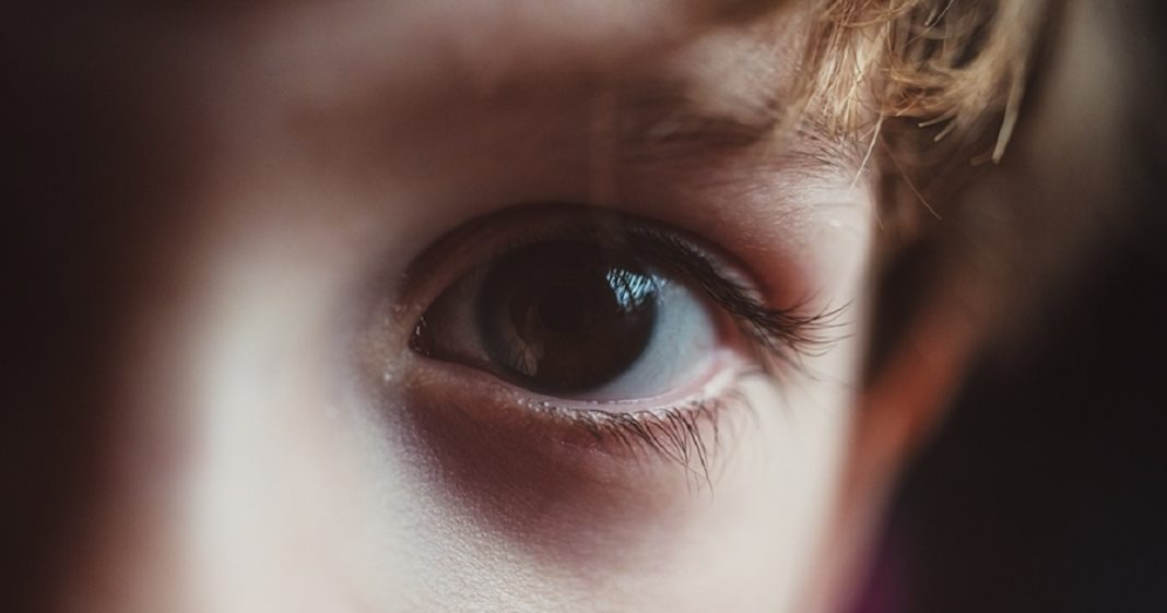 Teste de retina pode diferenciar com precisão o autismo do TDAH