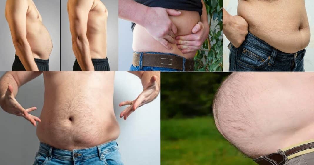 Tipos de barriga: má postura, estresse, gordura, metabólica, pré-diabética…